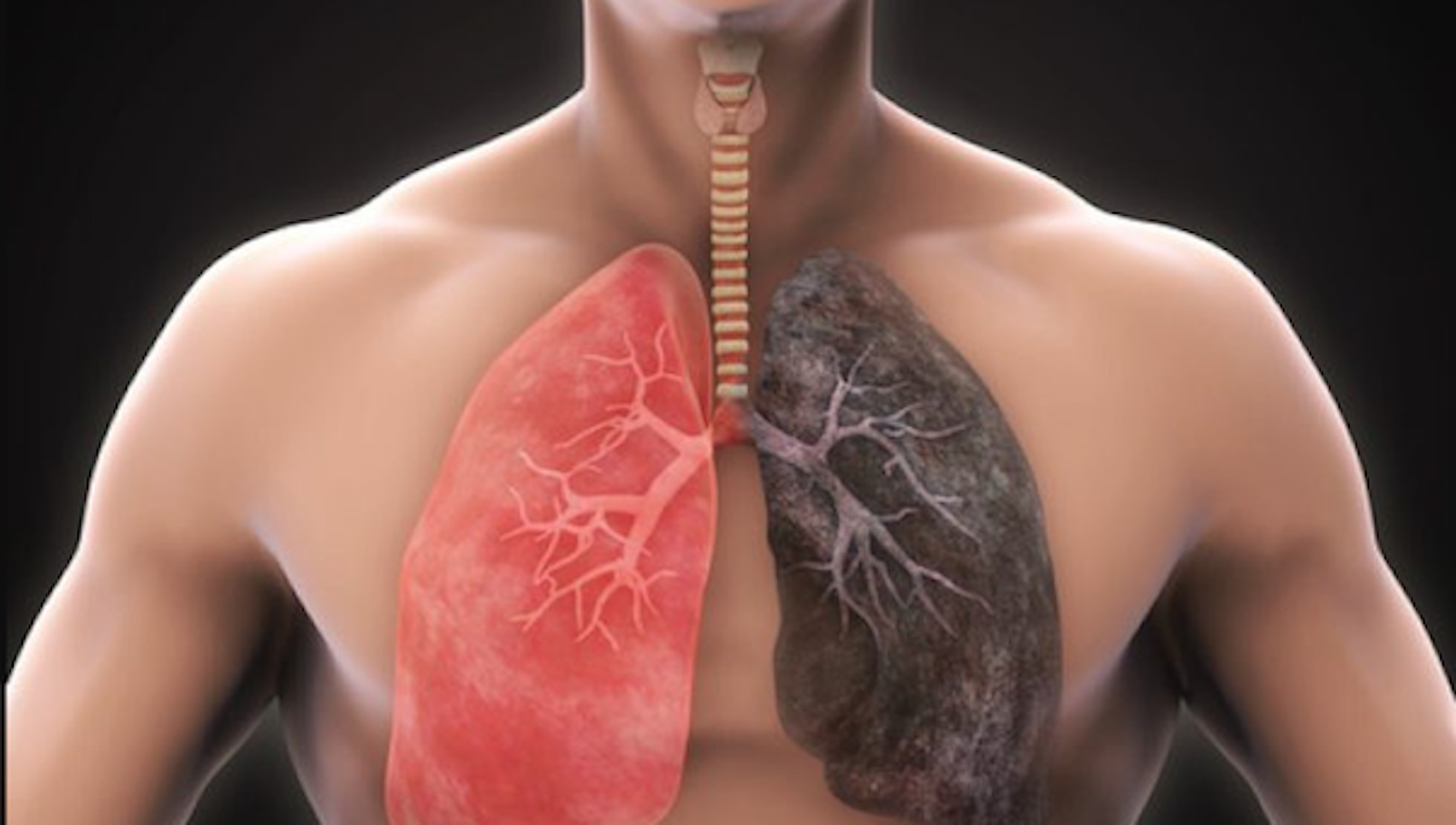 ayurveda-treatment-for-lung-disease-permanent-cure