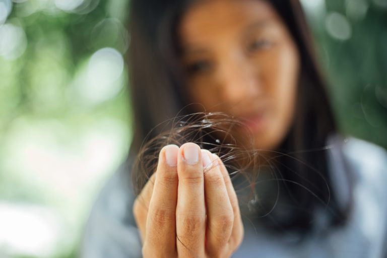 Hair Loss Treatment in ayurveda